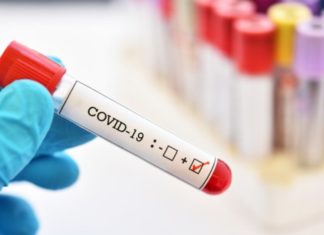 पिथौरागढका जिल्ला अधिकारीमा कोरोना संक्रमण पुष्टि